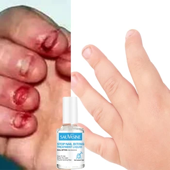 Crianças anti-roer as unhas puro extrato natural de comestíveis seguro nutrição óleo de bebê parar de comer as unhas
